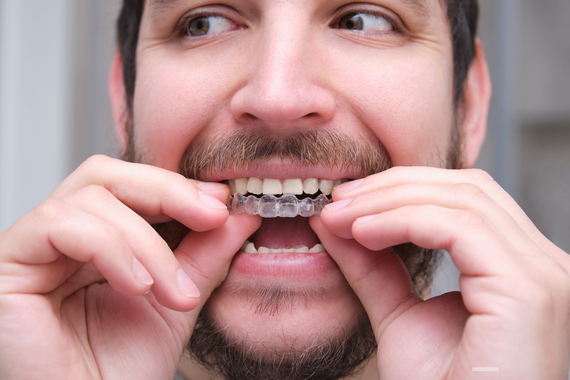 Braces & Aligners