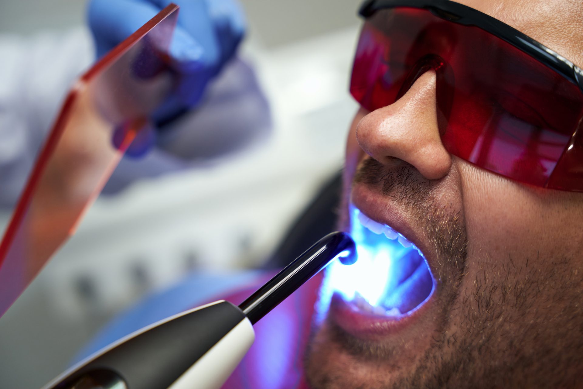laser-gum-surgery-vijayawada.jpg