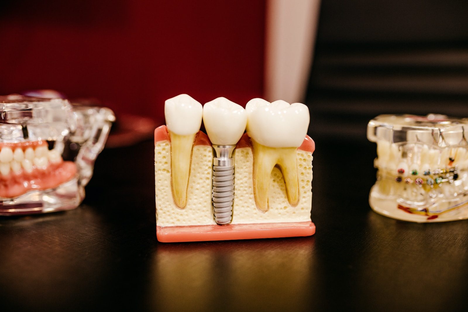 Root Canal Treatment in Vijayawada - Krishna Dental