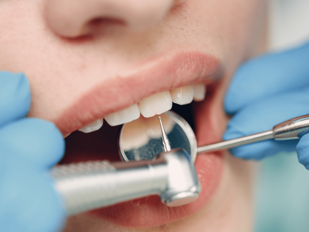 Dental Health Prevention Tips: 3 Ways that Can Save Your Smile