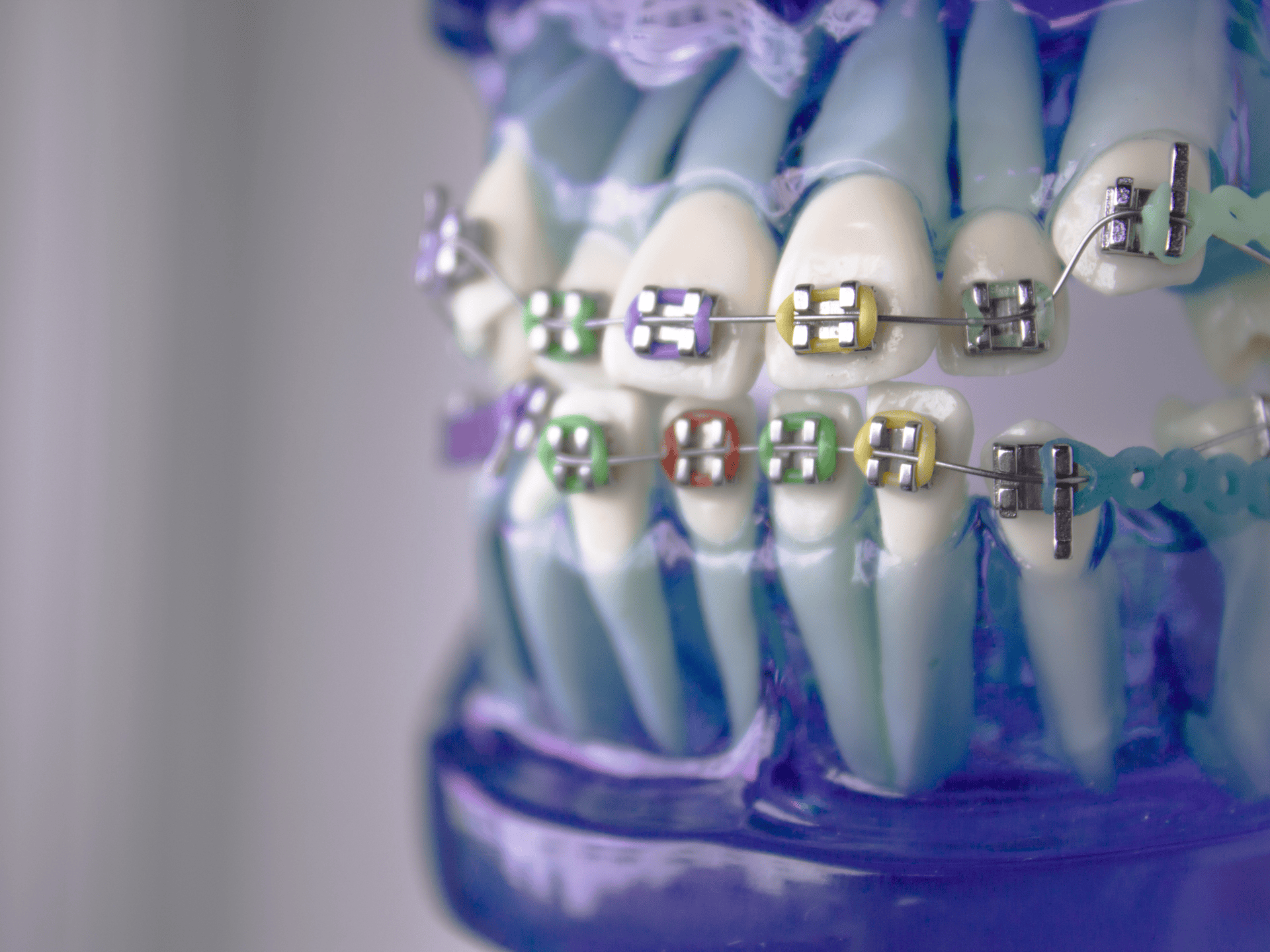 Comprehensive Dental Services in Vijayawada