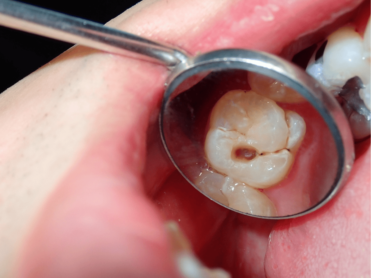 5 Best Reasons Why Regular Dental Check-Ups at Krishna Dental are Crucial for Your Health