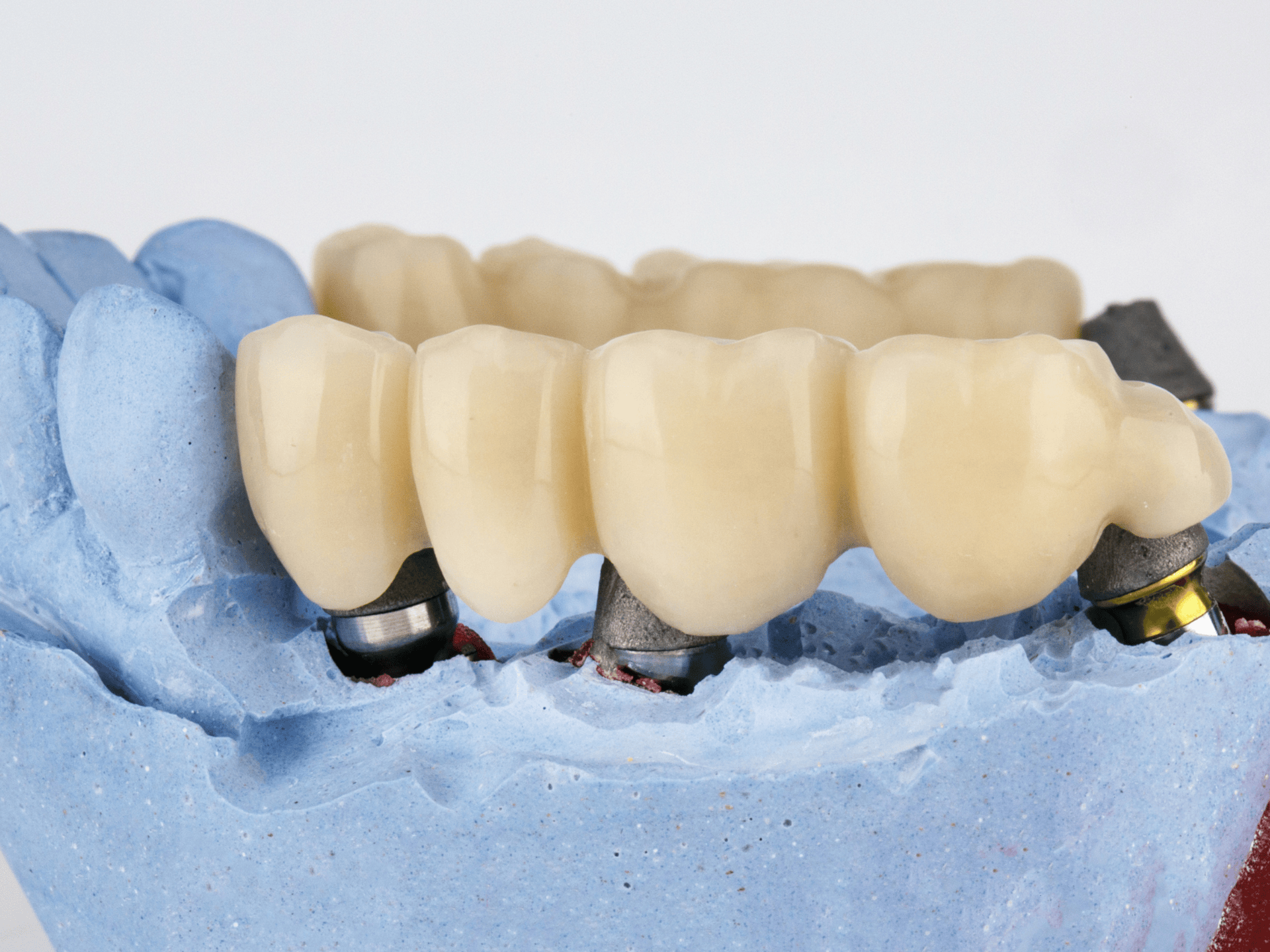 Comprehensive Dental Services in Vijayawada