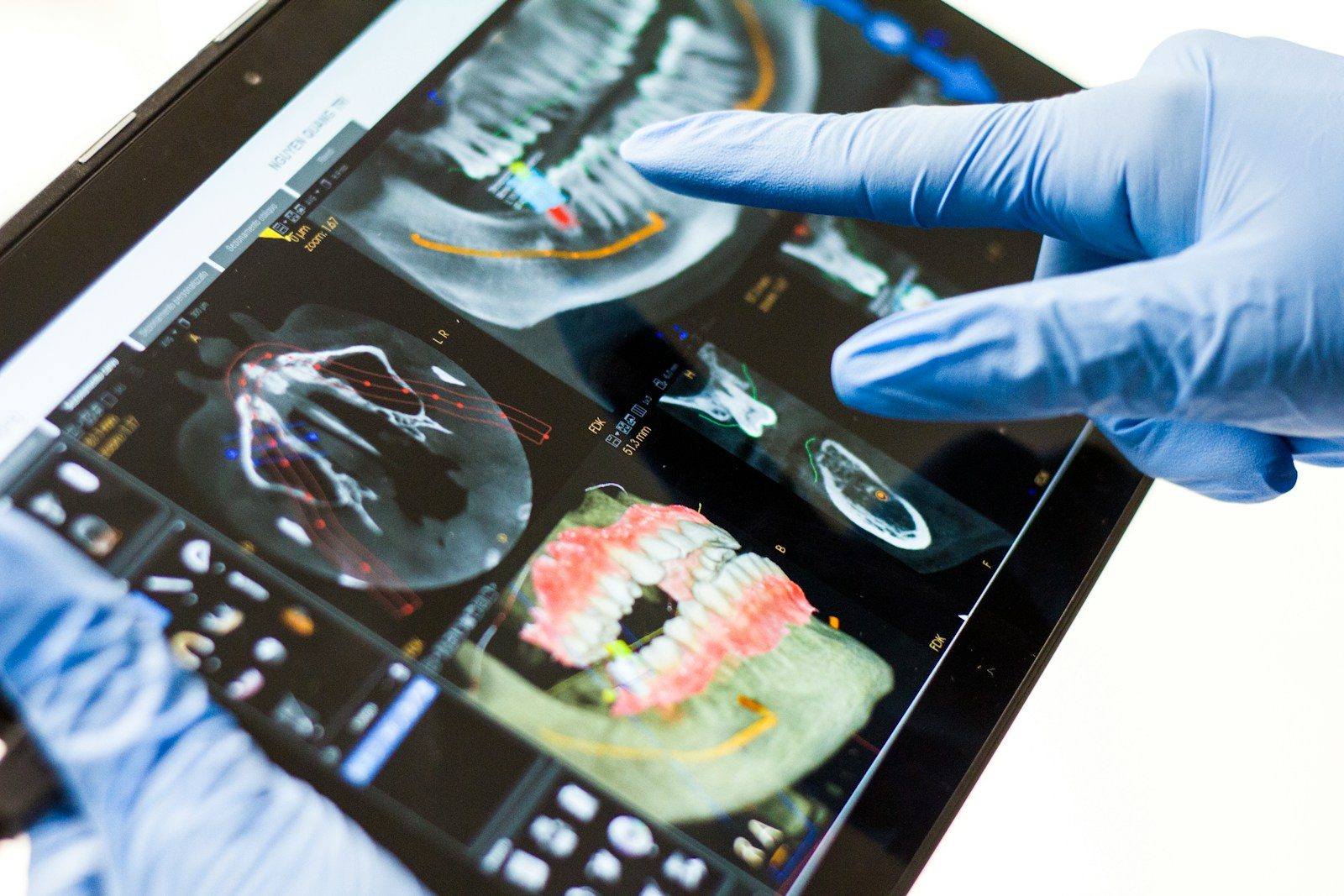 Cosmetic Dental Surgeries