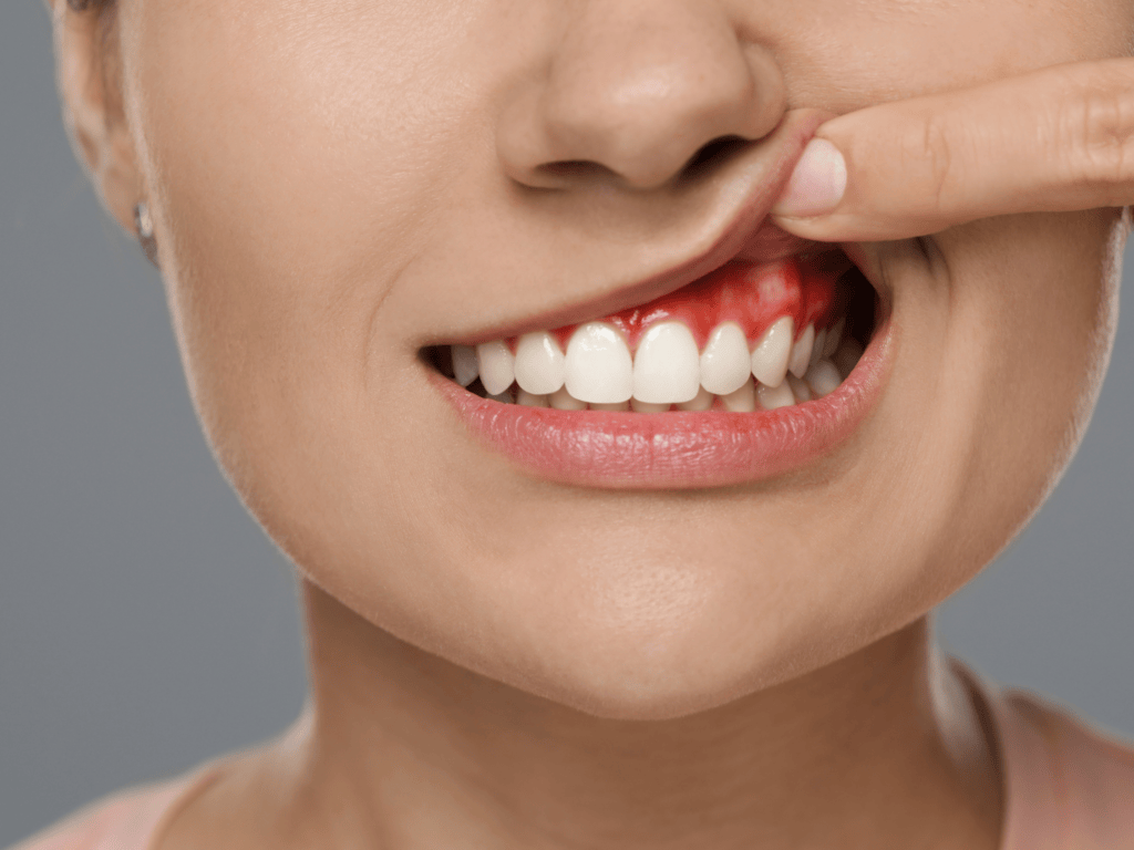 10 Essential Signs You Need to Visit a Dental Hospital in Vijayawada for Gum Health