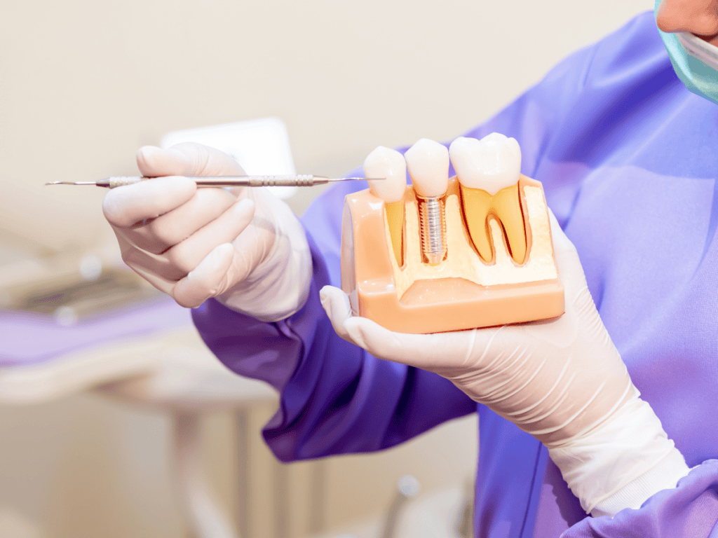 Top Reasons to Choose Dental Implants in Vijayawada for a Perfect Smile