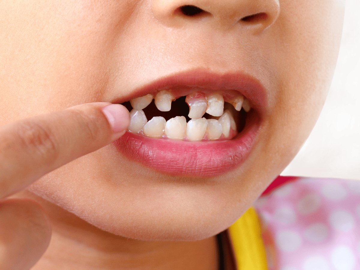 Finding the Best Pediatric Dentist in Vijayawada