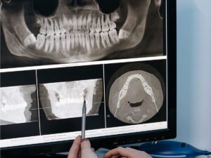 3D Dental Imaging