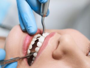 When Root Canal Is Required