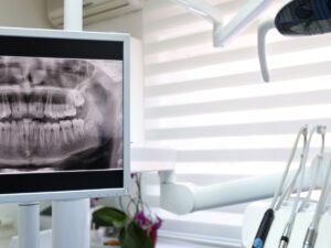 3D Dental Imaging