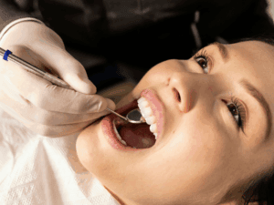 Dental Implant