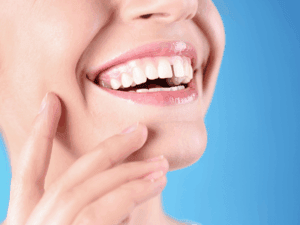 Teeth Gap