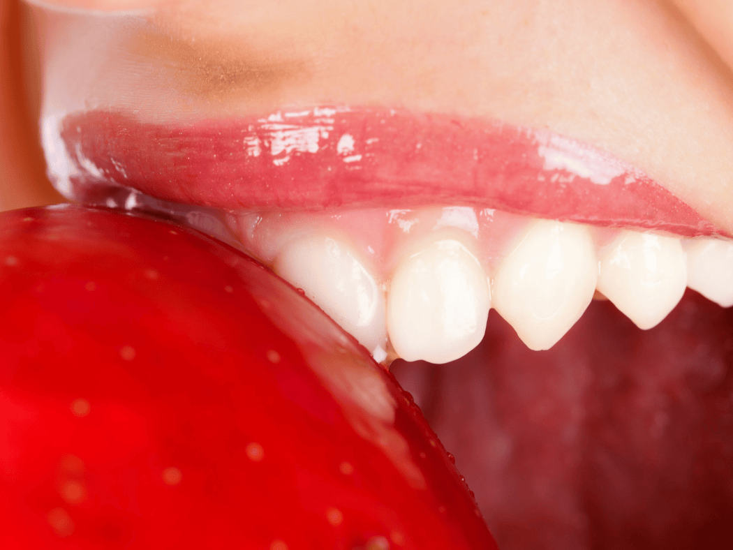 Top 10 Foods for Healthy Teeth in India: What to Eat for Strong Teeth and Gums