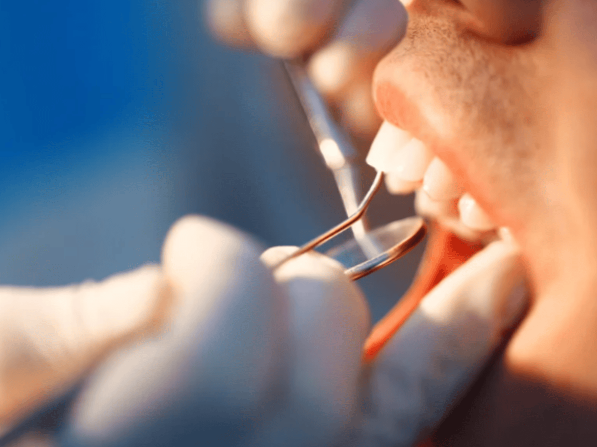 How Diabetes Affects Oral Health: Dental Care Tips for Diabetics 
